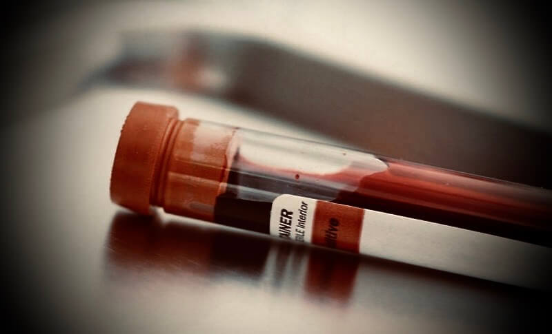 tubo analítica sangre